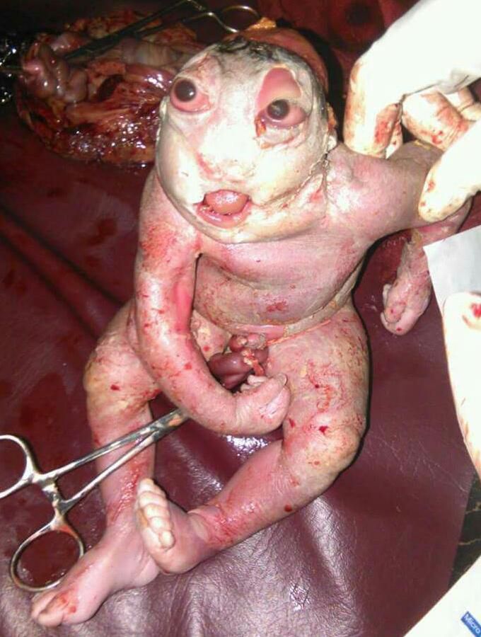Diagnosis?