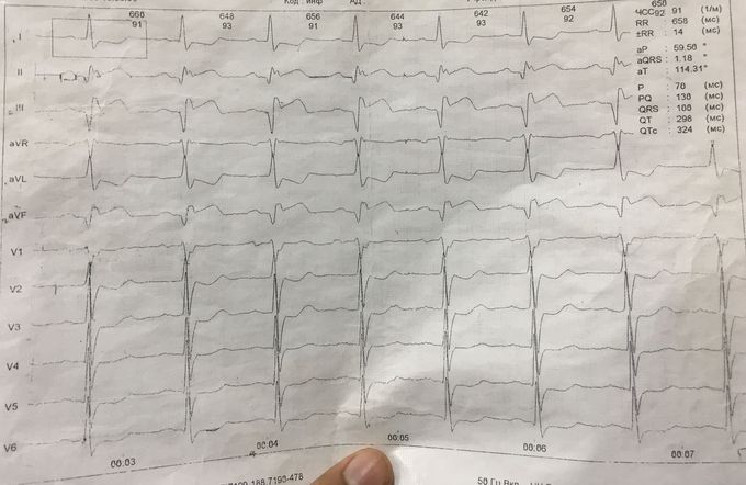 Confirm the diagnose