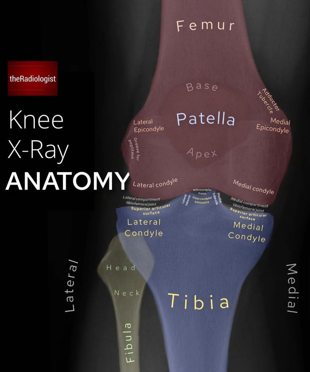 Knee X ray Anatomy MEDizzy