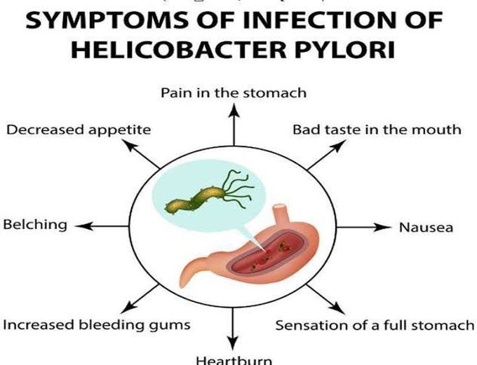 These are the symptoms of H pylori
