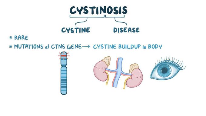 Cystinosis