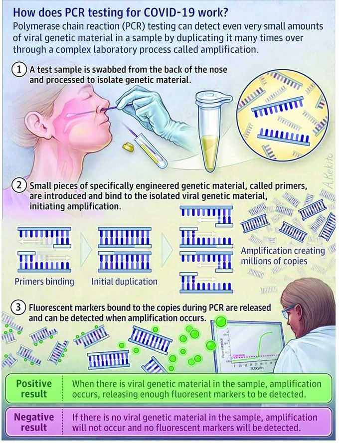 How to detect Covid-19 via polymerase chain reaction