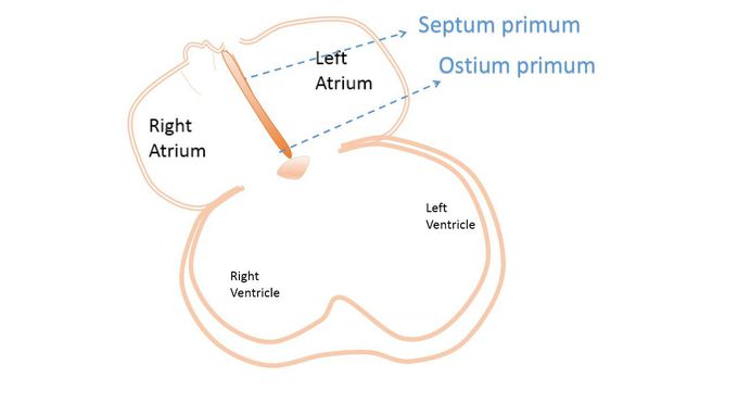 Development of Interatrial Septum: Overview