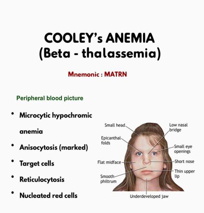 Cooley's Anemia - MEDizzy