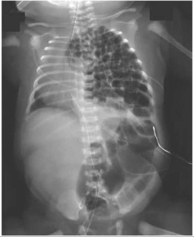 Diagnosis