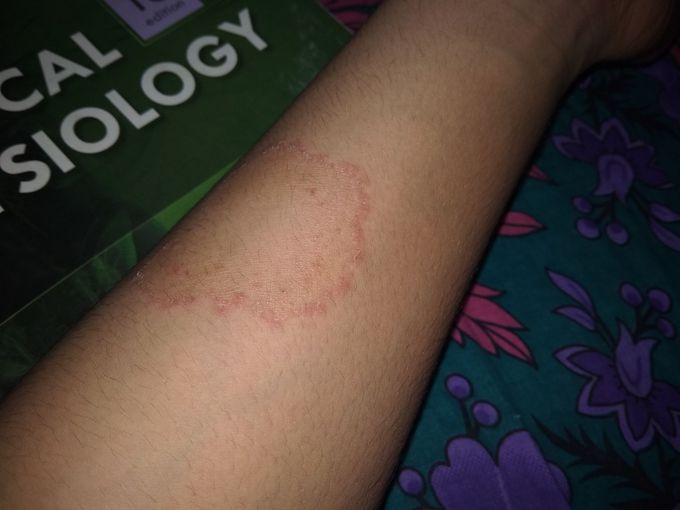 whats is your diagnosis and treatment?