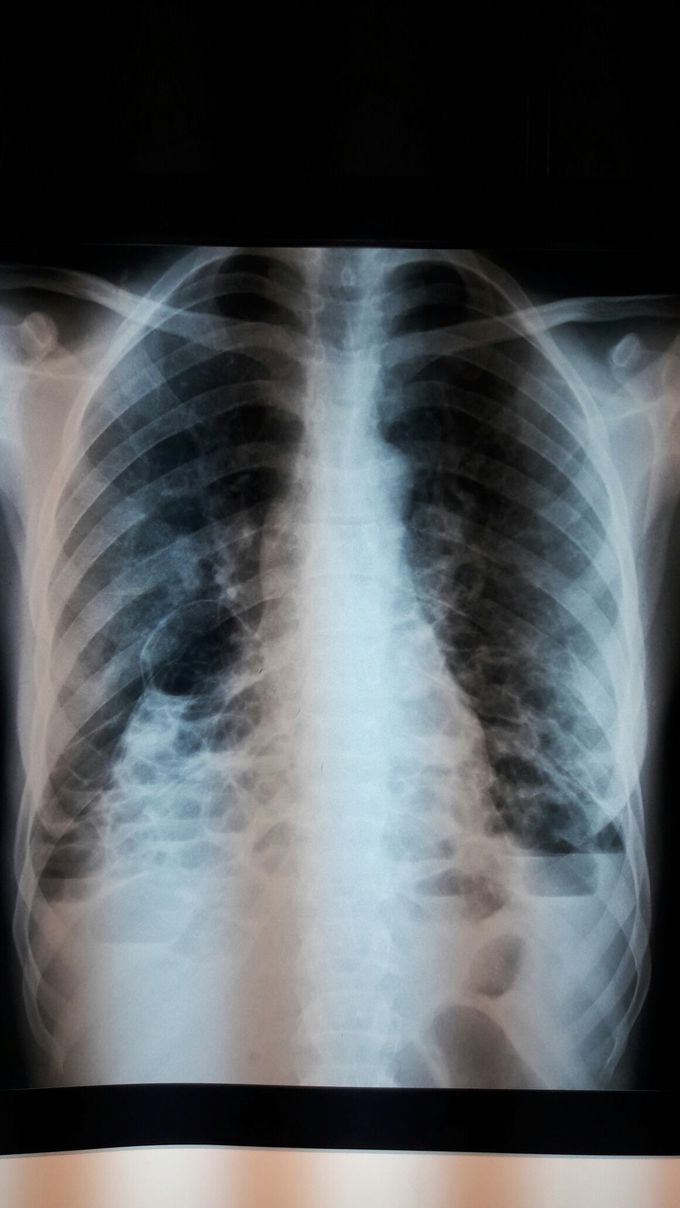 Diagnosis?