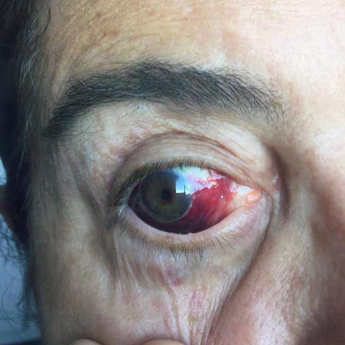 What is your diagnosis?