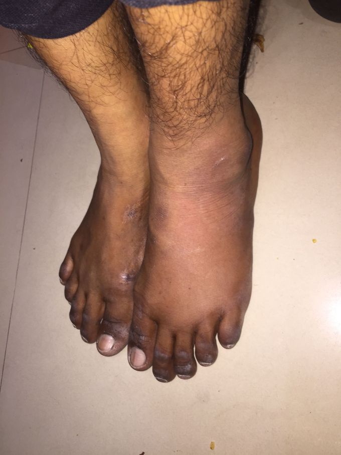 What is your diagnosis???
