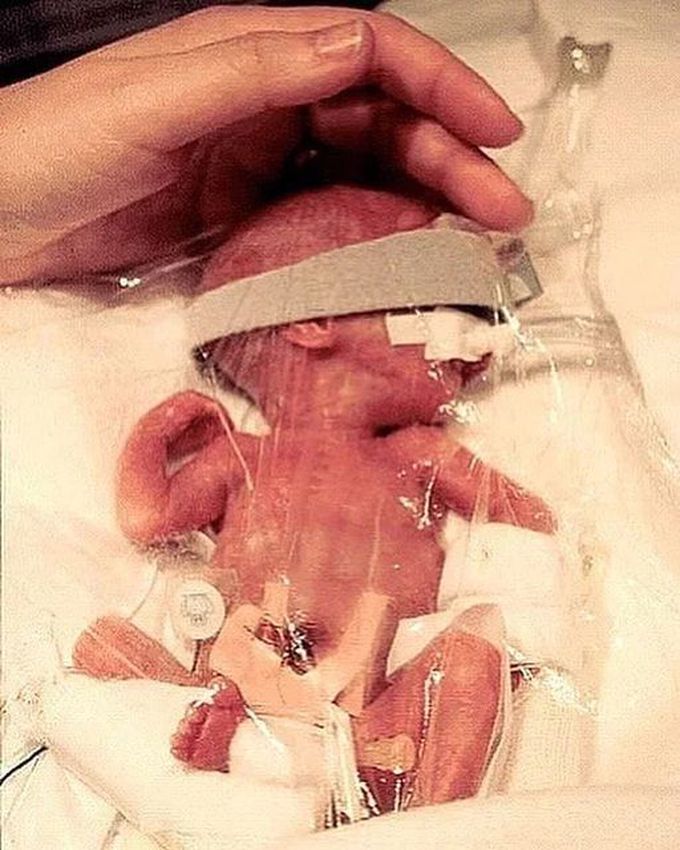 Premature Infants!