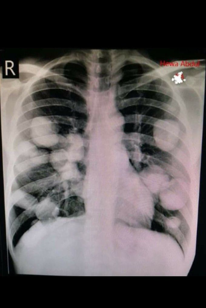 Guess Diagnosis ?!