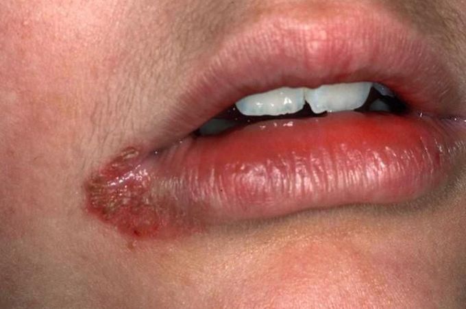 What's your diagnosis??!and what're the causes of it?