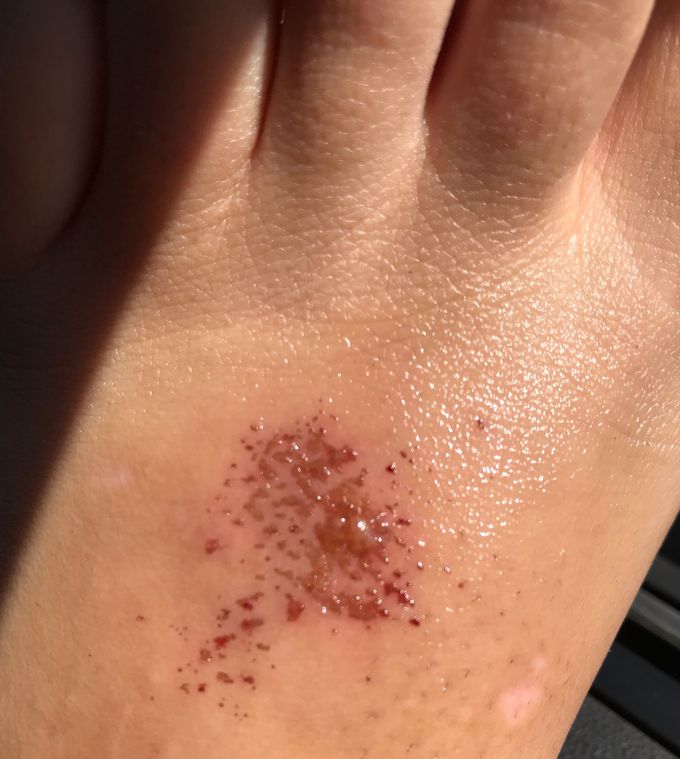 What is this?
