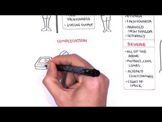 Acute gastroenteriris-Detailed explanation
