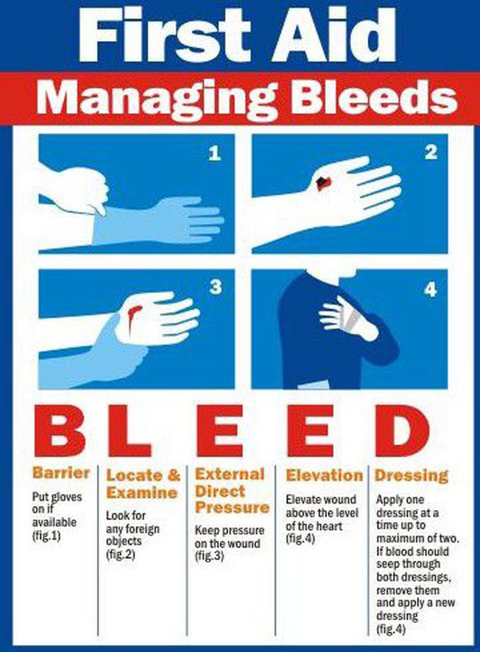 First AID Managing Bleeds