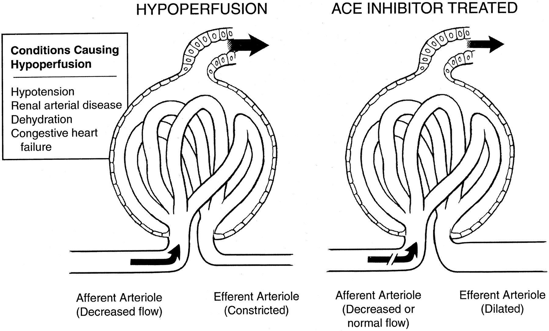 What Labs Indicate Acute Renal Failure