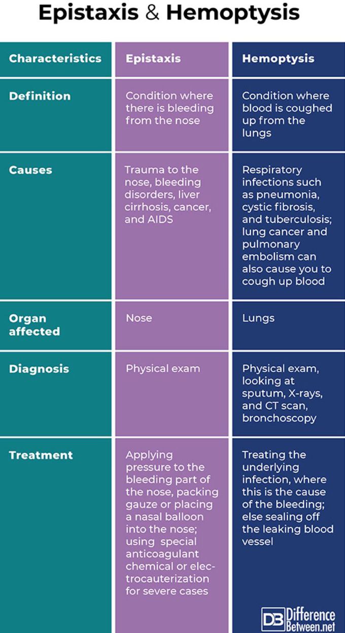 Hi everyone this is comparing between epistaxis and - MEDizzy