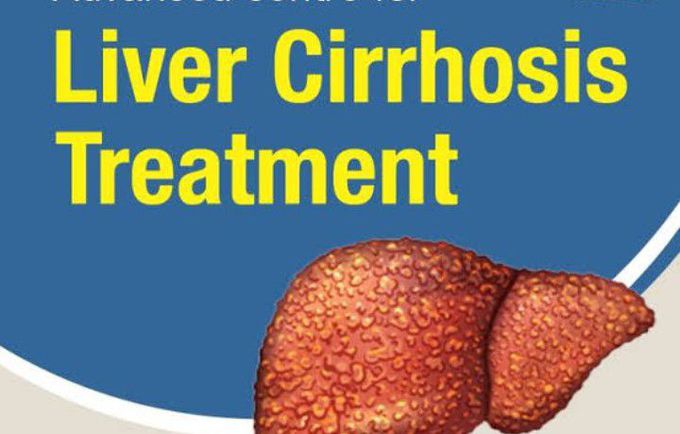 Treatment for Cirrhosis of liver
