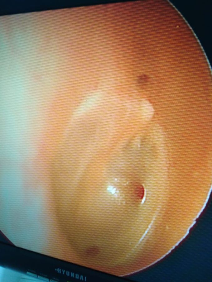 Case of otolaryngology