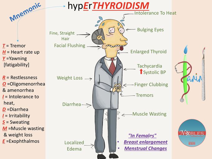 Hyperthyroidism