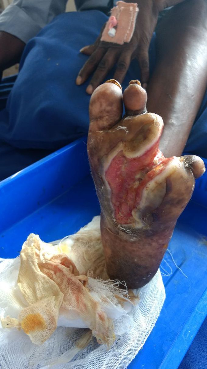 What is ur diagnosis？