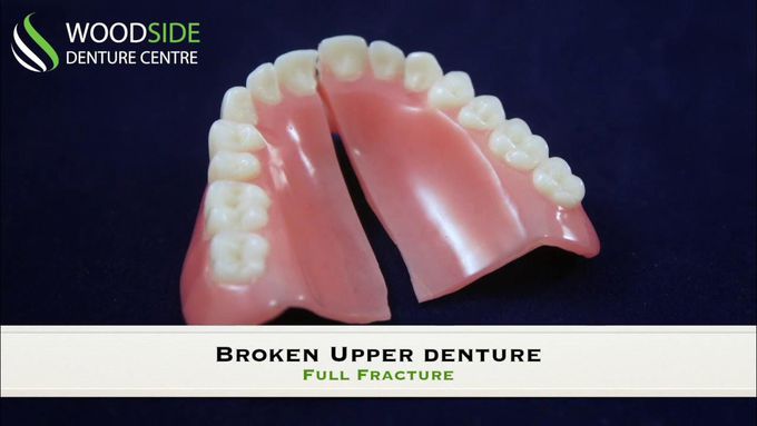 Denture Repair