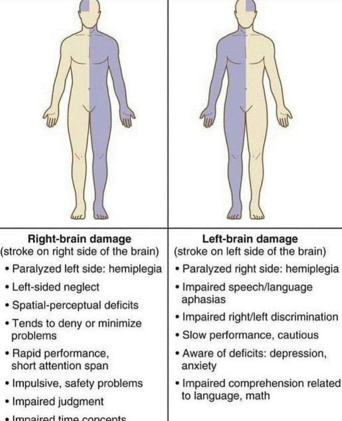 Damage of right brain vs left brain