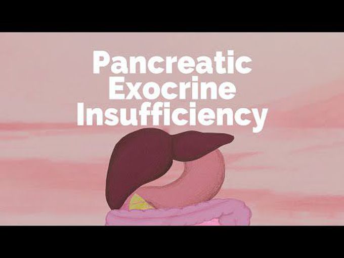 Carbohydrates-Pancreatic Exocrine Insufficiency