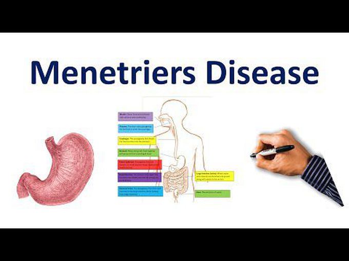 Menetrier Disease