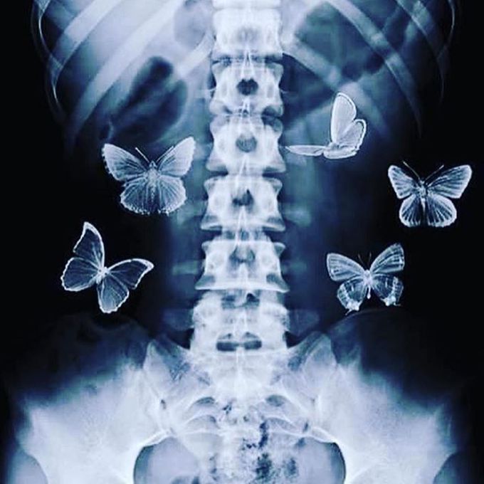 When medical girls use photoshop