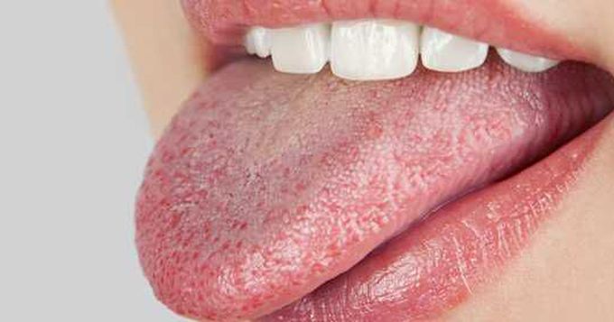 What could be diagnosis....
