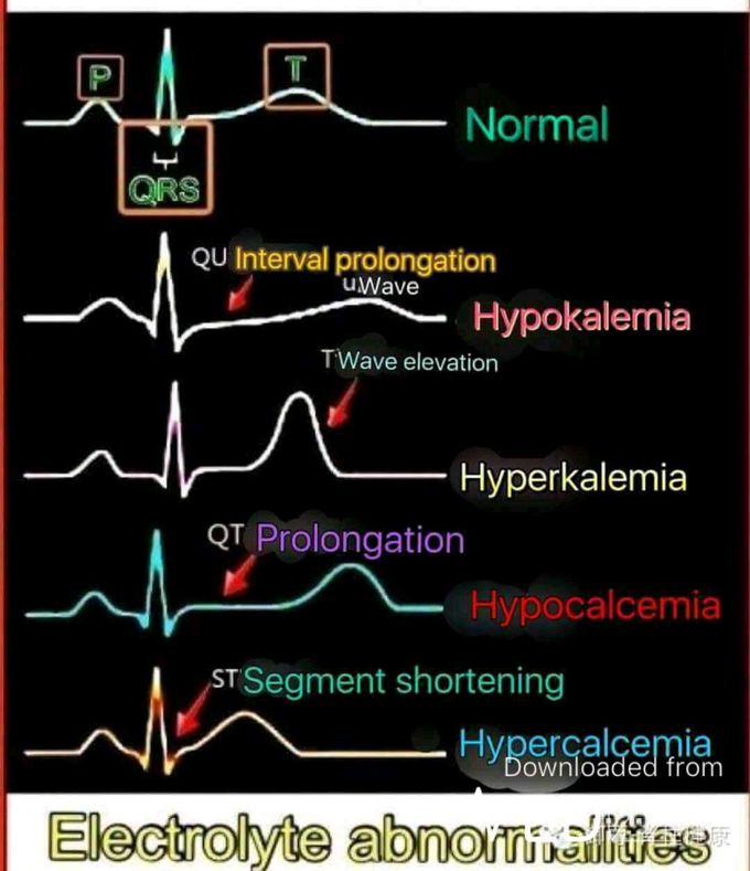 Some miss diagnose