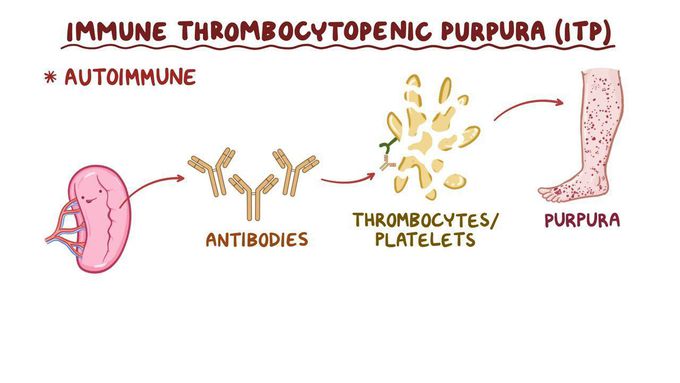 Causes of Thrombocytopenia purpura