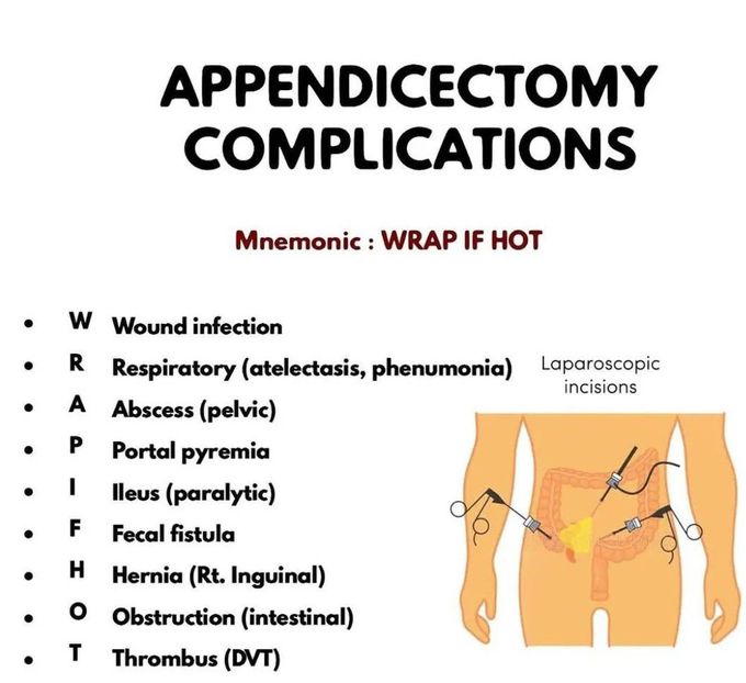 Appendectomy Complications