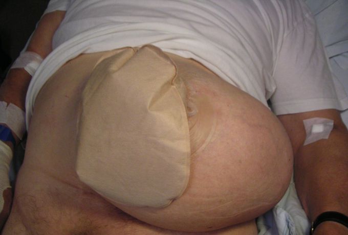 What is the diagnosis and its causes along with management?