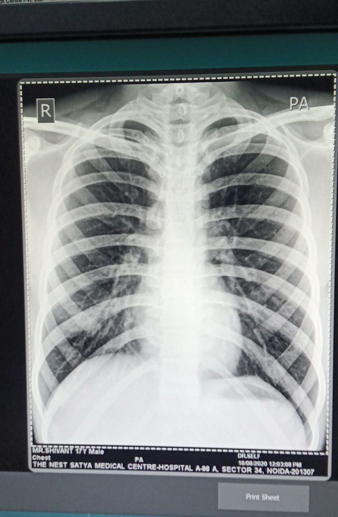 X-ray