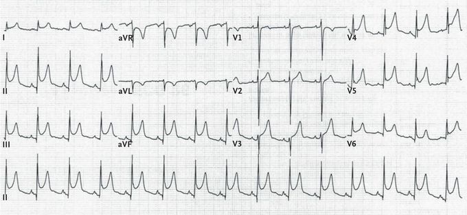 What it your diagnosis ?