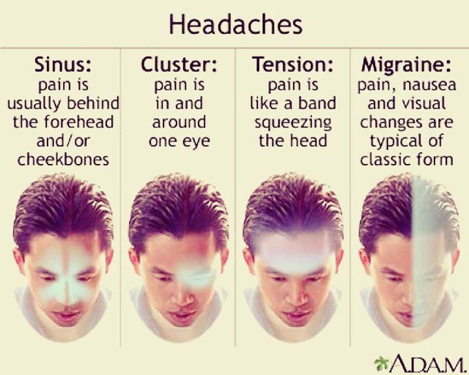 Headaches