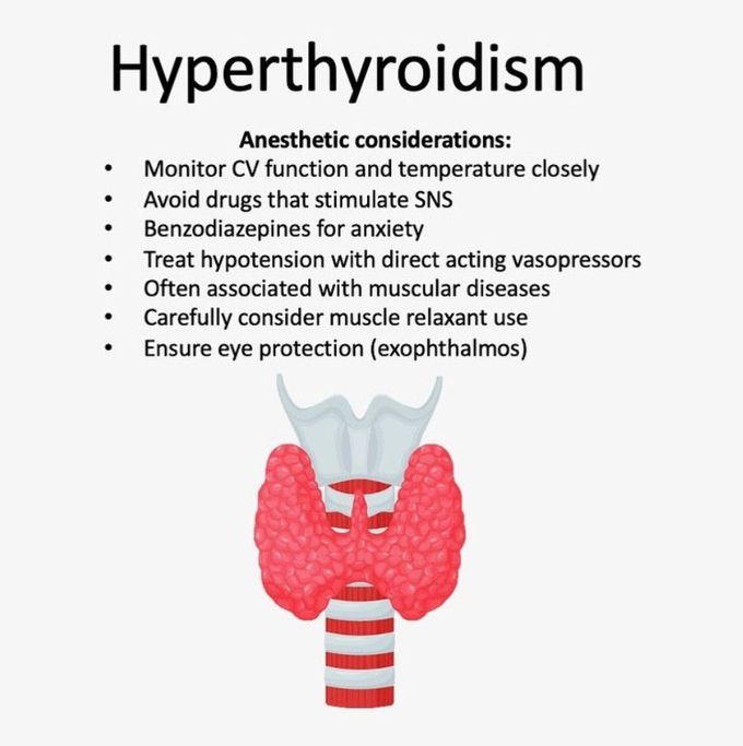 Hyperthyroidism