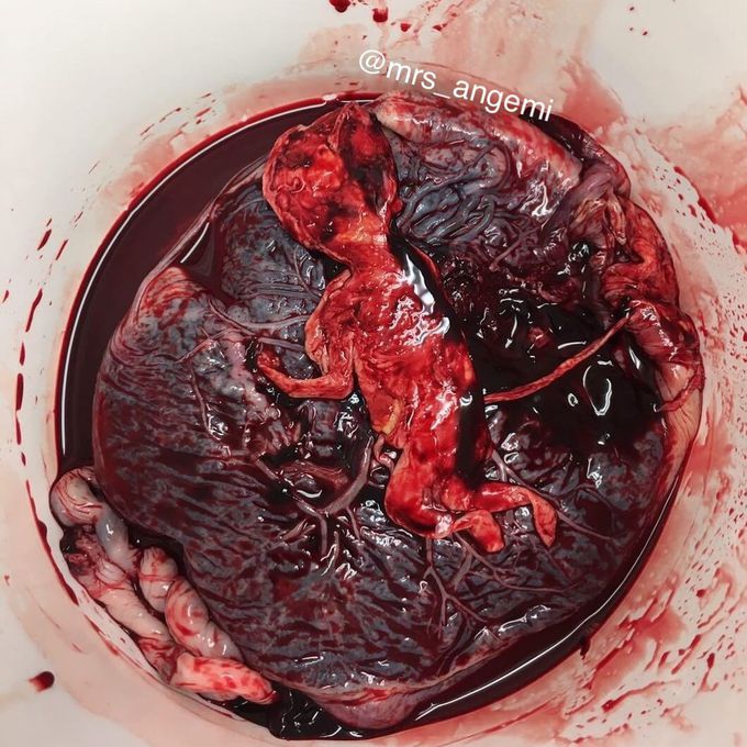 Mystery case , what is u’re diagnosis?