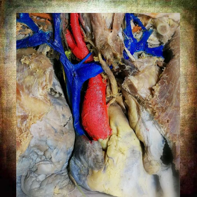 Anatomía artística lo real siendo resaltado...