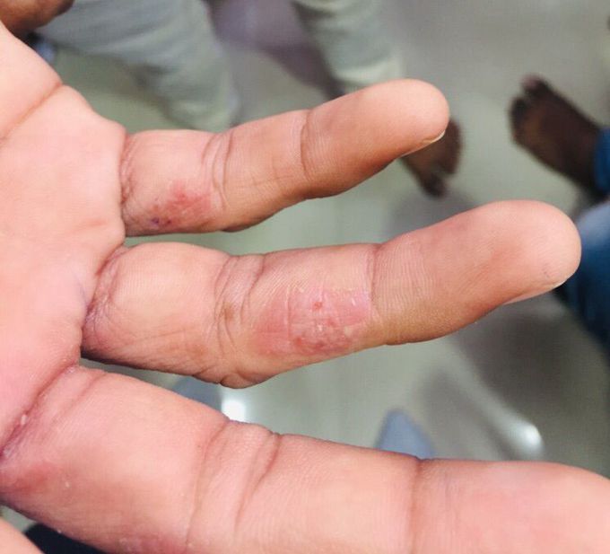 What is your diagnosis???