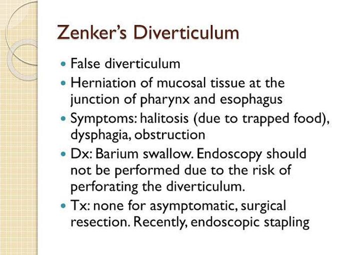 Zenker's Diverticulum