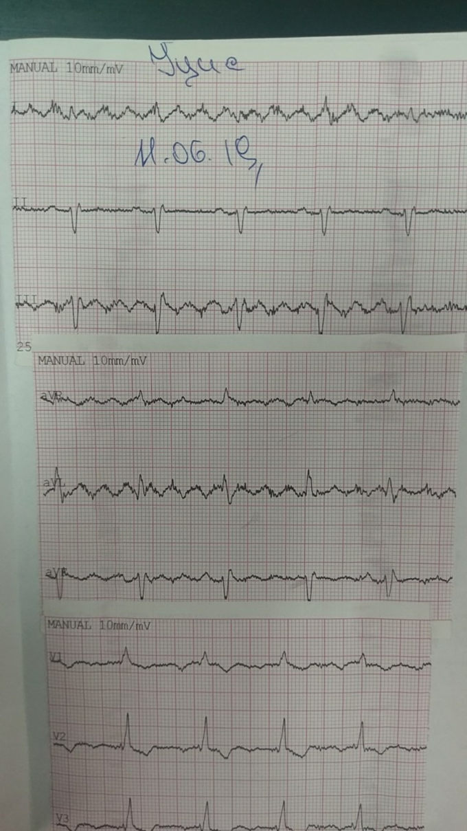 Cardiology ecg ekg - MEDizzy