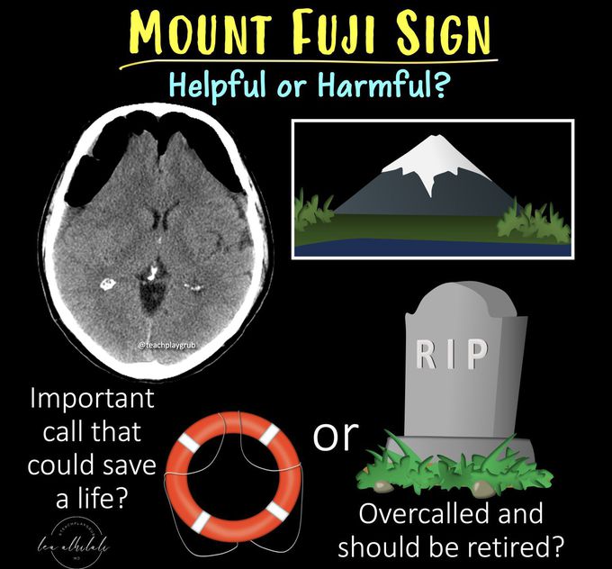 Mounfuji sign