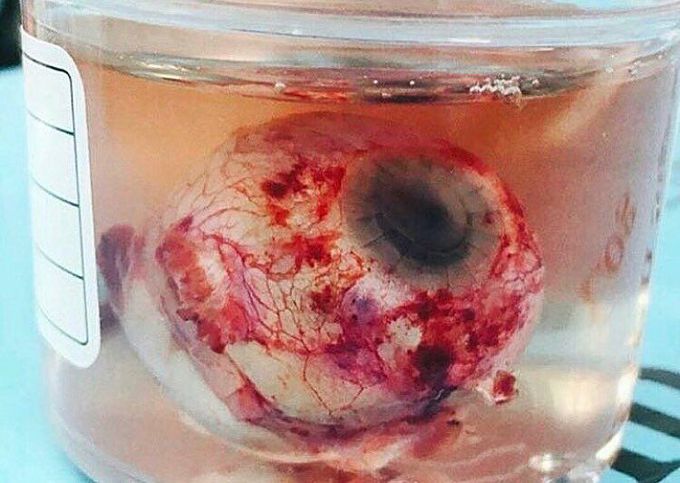Eye in a jar!