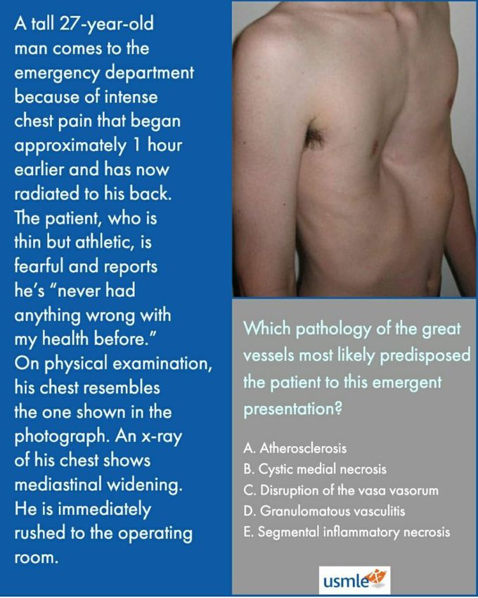 Usmle question