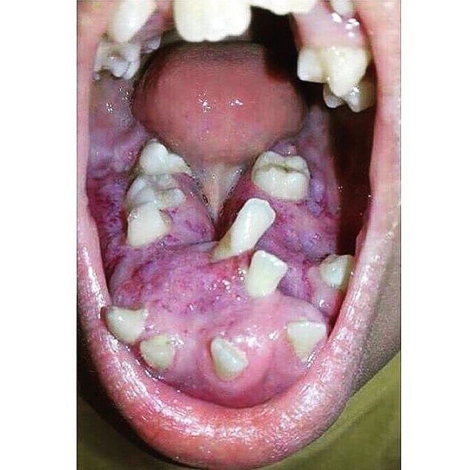 DIAGNOSIS