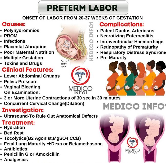 Preterm Labour