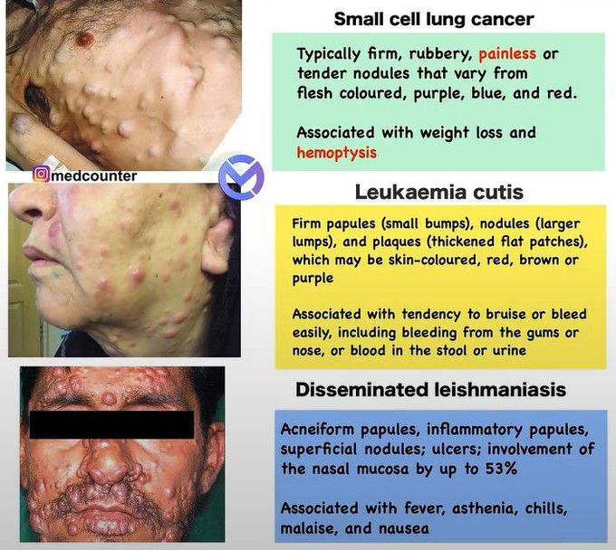 Three severe skin diseases